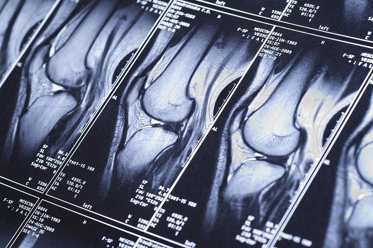 Knee Scans